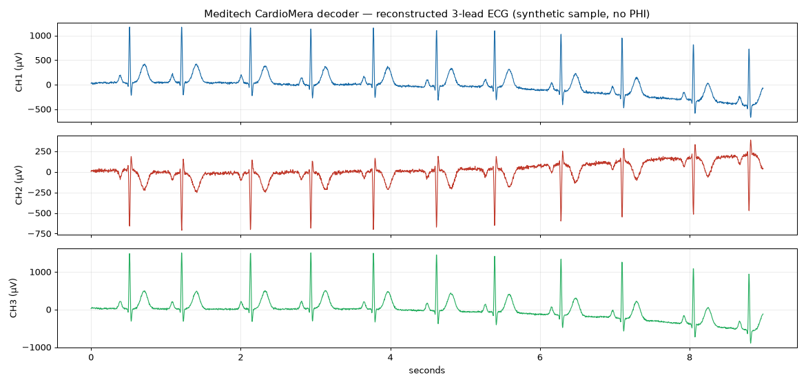 重建的 3 导联 ECG(合成样本)
